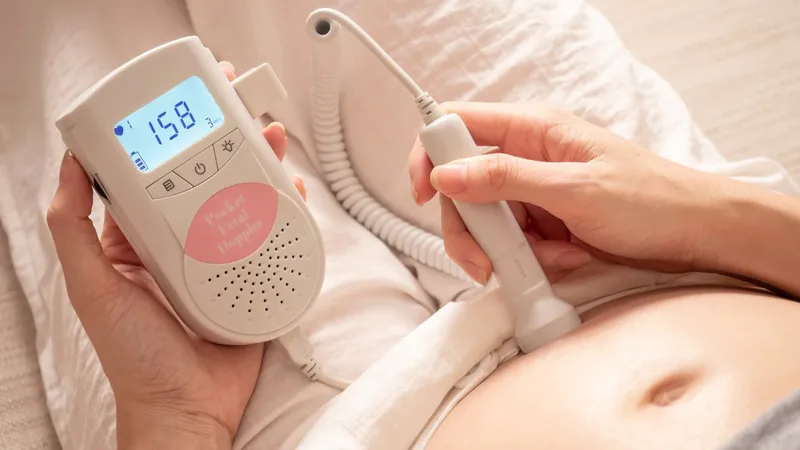 Monitor fetal doppler